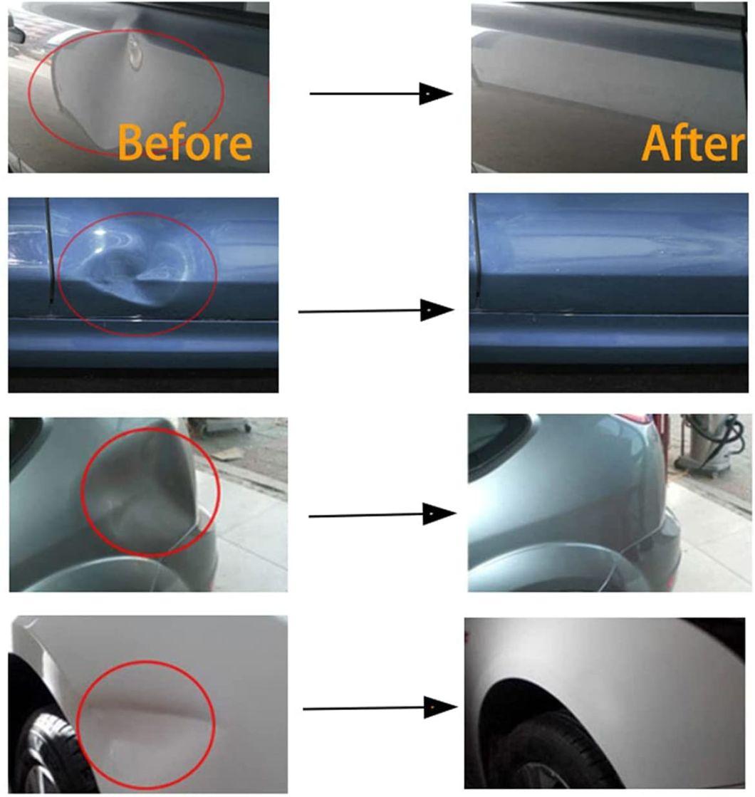 Viktec Auto Body Minor Dent Removal Tool Set Dent Puller Paintless Car Dent Repair Kit