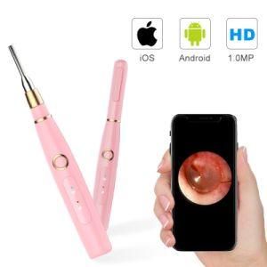 1080P FHD WiFi Ear Scope 4.3mm Wireless Ear Scope Camera USB Ear Endoscope with 6 LED Lights for Android Ios Smartphone